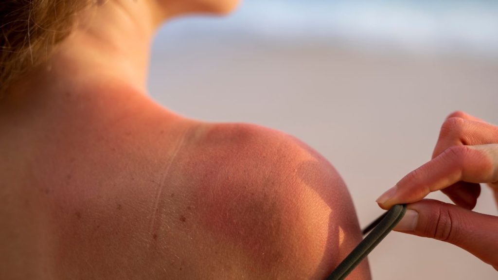 Rayos UV