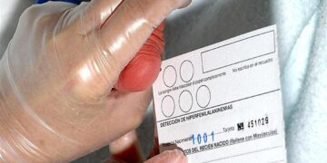 Sanidad amplía la prueba del talón a 21 enfermedades y eleva hasta los 74 años el cribado colorrectal