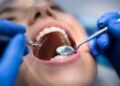 Sanidad ampliará la atención dental gratuita para mayores, menores, embarazadas y personas con discapacidad