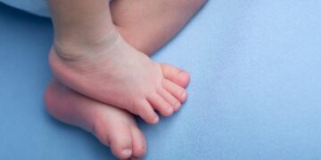 La prueba del talón se amplía a 35 enfermedades y estrenará resultados digitales para las familias