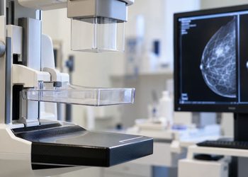 El Pleno de Alcalá rechaza una propuesta para reducir las listas de espera de mamografías y mejorar la detección precoz 3 El Pleno de Alcalá rechaza una propuesta para reducir las listas de espera de mamografías y mejorar la detección precoz